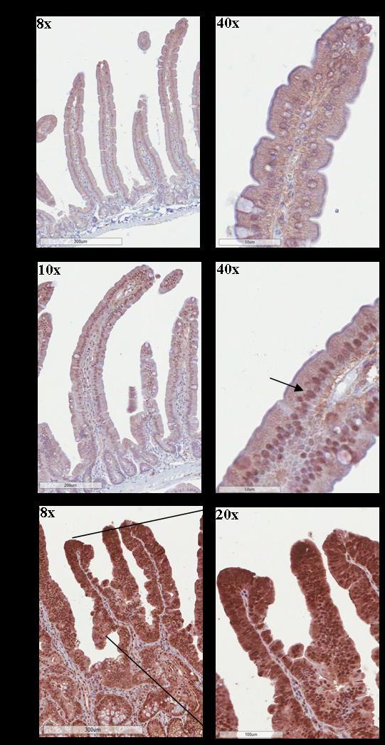 Figure 5.6 p44/42 Mapk (Erk1/2) (total Erk) expression in small intestine of BRaf CA mice (n = 6).