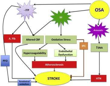 Pathophysiology of OSA Effects on Stroke IH: Intermittent Hypoxia, ITP: Intra-thoracic pressure, SNA: