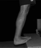 Foot and Ankle Exercises: Toe abduction and adduction and flexion Barefoot strengthening exercises Resisted adduction: Increases