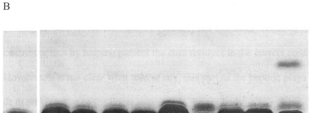 (A) Electrophoresis of the phage clones isolated from the IOA.