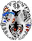 neuroimaging studies as represented by