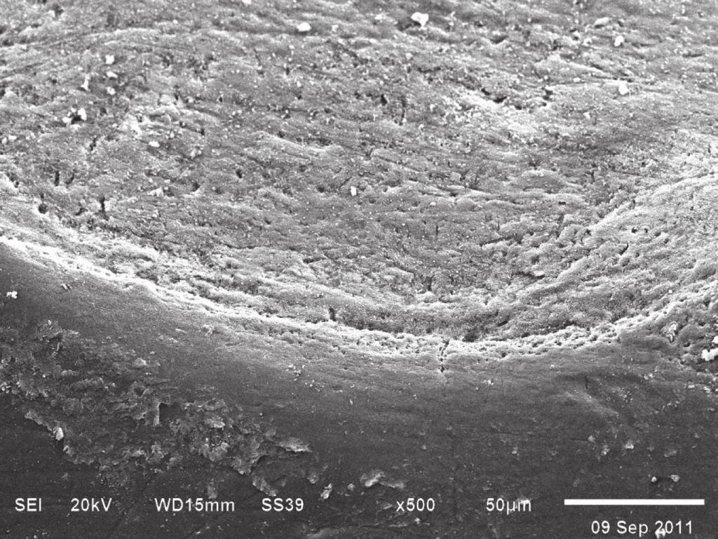 At higher magnification, the opening of the dentinal tubule was surrounded by a dentin Discussion matrix which consisted of a network of collagen In this study, the abraded enamel surfaces Figure 5