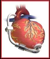 Echo in Heart Failure Karima Addetia, MD Heart Failure: