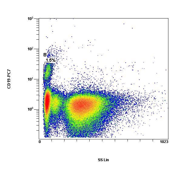 Flow cytometry gating strategy active CLL 1.