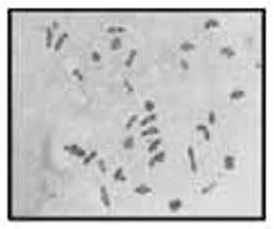 24 : Metaphase I (Side view) Diacrisia obliqua : Somatic metaphase complement possessed 62 chromosomes (2n=62). All chromosomes are dot like in appearance. Male, 2n=62 (Fig.