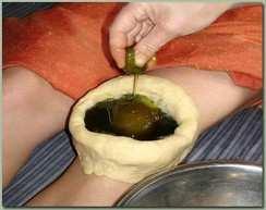 Janu Vasti (Local treatment for knee pain) This is a special treatment in which the hot medicinal oil is kept on the knee, very effective in treating different conditions of the knee joints such as