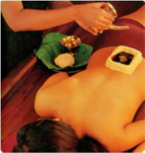 Tratamientos locales con aceite Kadee Vasti (Local Treatment for Low Back Pain) Approximate duration 35 min (Mín 5 days) A small receptacle is made in the lower back with a dough and then filled with