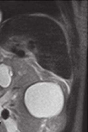MRI image clearly