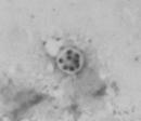 Diarrheal disease-causing protozoa: Giardia lamblia Entameba histolytica Cryptosporidium parvum Cyclospora cayetanensis Adults and children estimated to