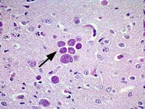 Fate of Tissue Cysts The tissue cysts are infective when ingested by cats or eaten by other animals.