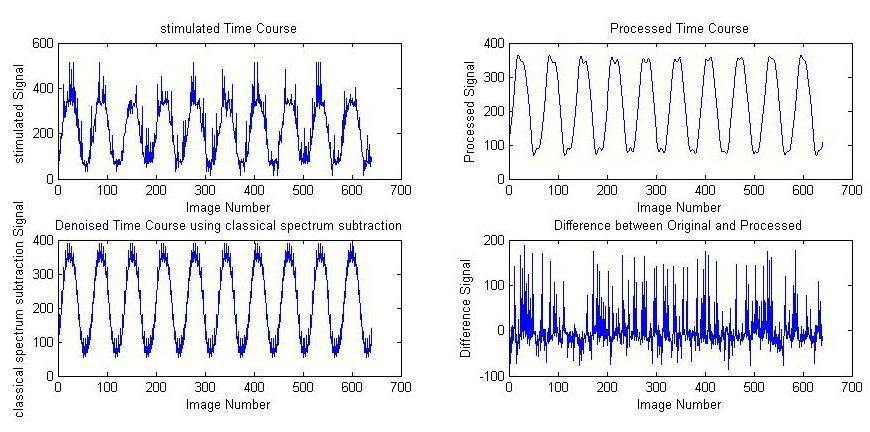 Fig 5 Result from simulation without baseline variation. In Fig. 8 when used actual data for pixel time course containing neuronal activation (length = 512 points) and Fig.
