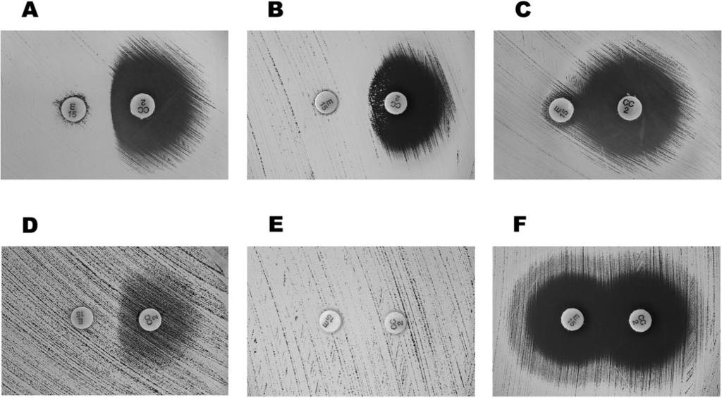 1720 STEWARD ET AL. J. CLIN. MICROBIOL. FIG. 1. This figure shows the six phenotypes observed during CLI induction testing of by disk diffusion. E 15, ERY disk (15 g); CC 2, CLI disk (2 g).