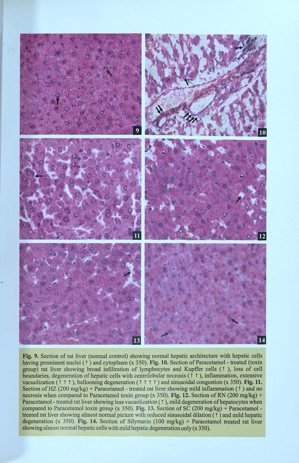 ... Fig. 9. Section of rat liver (normal control) showing normal hepatic architecture with hepatic cells having prominent nuclei (t ) and cytoplasm (x 350). Fig. 10.