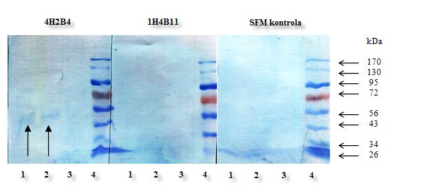 Sliki 10 in 11 predstavljata encimskoimunski test mab s proteini virusov H5N1 in H5N2. Sliki 10 (zgoraj) in 11 (spodaj): Encimskoimunski test izoliranih mab z ločenimi virusnimi proteini H5N1 in H5N2.