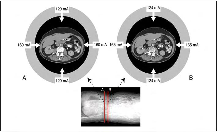 Figure 2. Automatic Exposure Control for CT examinations. The attenuation through one region of the body, A, is less than another, B, and is less in the anterior-posterior projection than the lateral.
