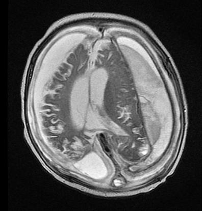 MRI Head Images: 2