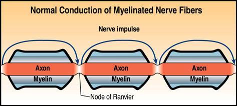 Effects of Myelin Allows action potential to skip along the membrane. - speeds conduction.