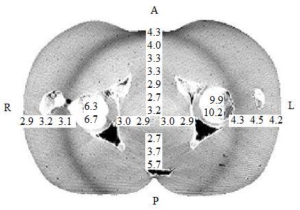 Figure 1-5. TLD measured doses (cgy) within RANDO pelvic phantom using OBI system (Used with permission from: N. Wen, H. Guan, R. Hammoud, D. Pradhan, T.
