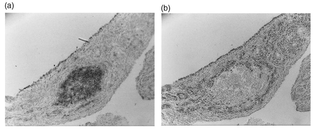 Tertiary Lymphoid Organ in a non-lymphoid Setting anti-cd20 (B-cells); Ab-Wue-1 (plasma cells)