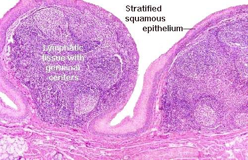 Contain multiple lymphoid follicles overlain by epithelial crypts Crypts trap bacteria which work their way into the