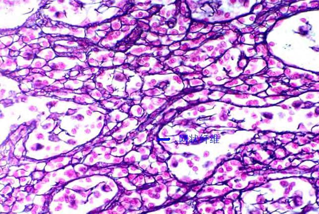 2. lymphoid tissue Formed by