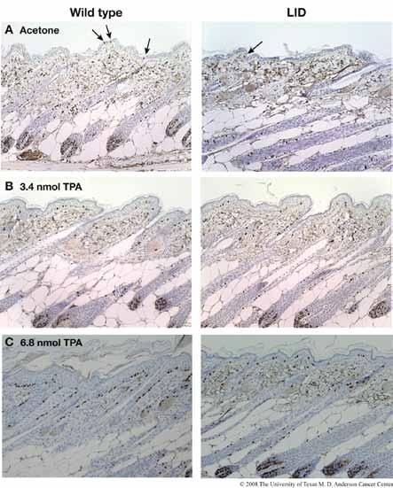 Reduced Circulating IGF-1 Decreases Epidermal Proliferation Both in the Absence and Presence of TPA