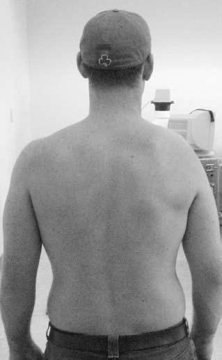 position and muscles activated by pressing the medial border and inferior angle to the thorax or palpating or tapping over the lower and middle trapezius (Figure 1[c]).