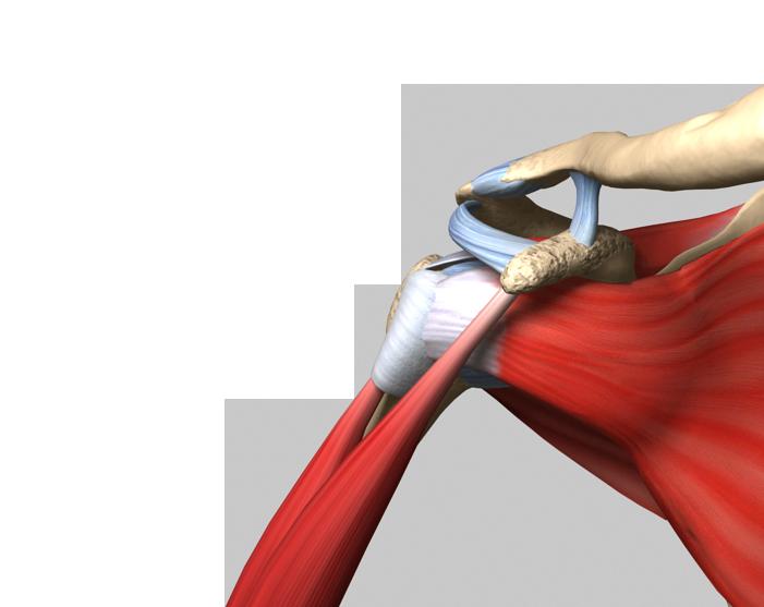 Reverse Total Shoulder Replacement Reverse Total Shoulder Replacement is a surgery performed to improve shoulder