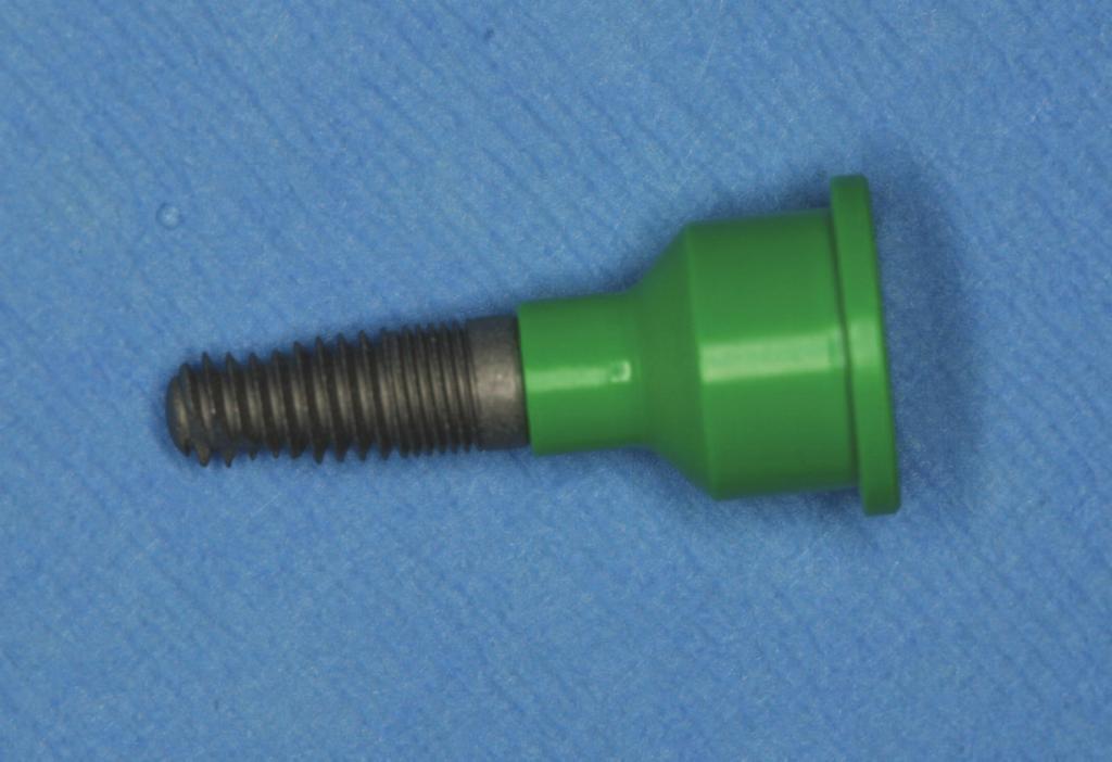 Fabrication of a fixed appliance would require sinus augmentation to allow for more implants to be placed in the posterior region to support such a device.