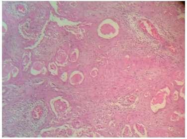 Histological Typing of Odontogenic Tumours, Jaw Cysts, and Allied Lesions. 1st ed. Geneva: World Health Organization; 1991. p. 35-6. [2] Van Wyk CW, Padayachee A, Nortjé CJ, von der Heyden U.