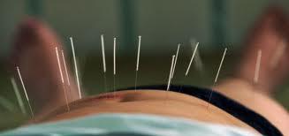Other less studied RX Acupuncture Surgical: uterosacral