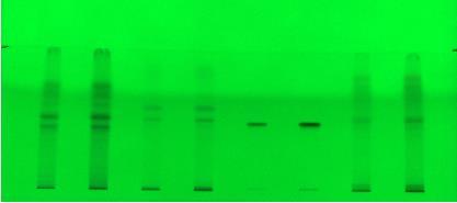 Figure 1: TLC fingerprint profile of ethyl acetate fraction of methanolic extract of leaves of