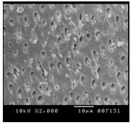 2.2 SEM Evaluation and Statistical Analysis Each fragment was first viewed at low magnification (x30) by the