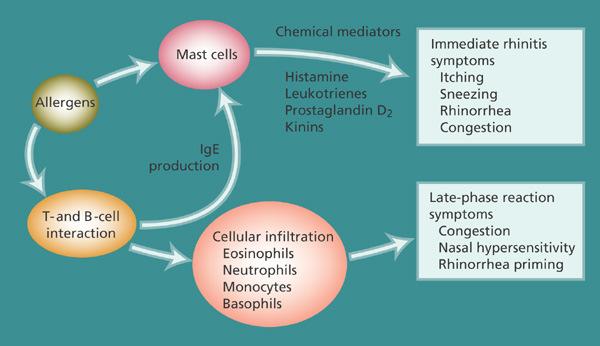 Allergic Rhinitis: Mechanism Allergic rhinitis (AR) is characterized by nasal mucosal inflammation resulting from immunoglobulin E (IgE) mediated hypersensitivity reaction.