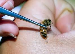 The use of pure venom injections and well placed bee stings is increasing in Western countries as an alternative to heavy (and sometimes ineffective) drug use, which is often associated with numerous