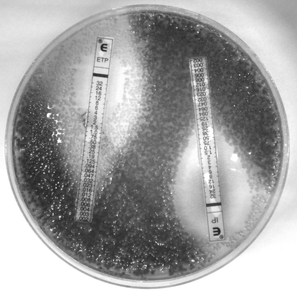 123 Figure 1. Drigalski agar media with ertapenem (ETP) and imipenem (IP) E-test strips 124 (BioMérieux) plated with a dry-cotton swab dived into an overnight stool culture in a 0.