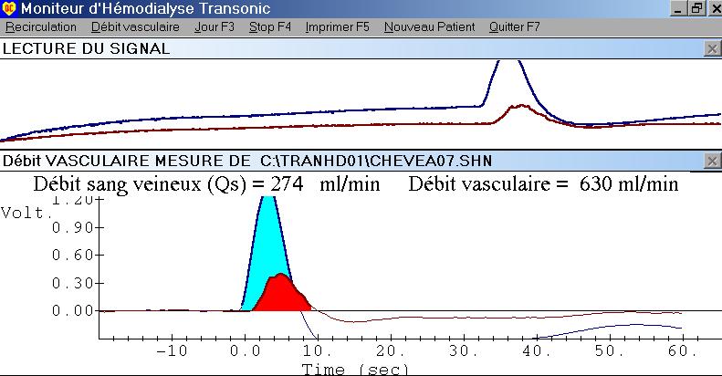 VAF measurement (ultrasonic dilution)