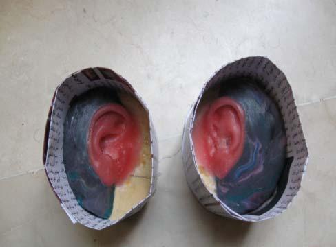 Investment technique To create a usable mold that could be poured, an additional wax piece was formed around the posterior aspect of the original wax ear, in a distinct colour that