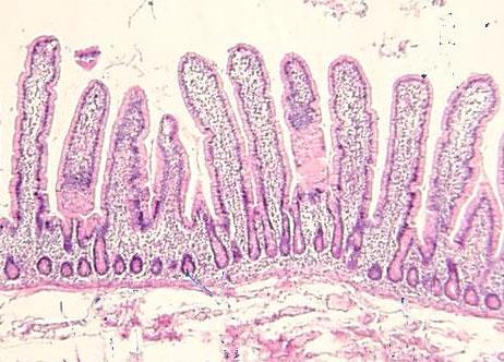 Villi Infolding in the lining of the small intestine