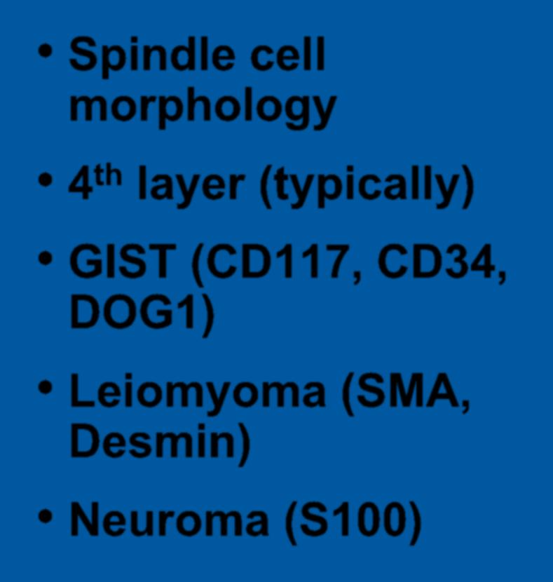 Spindle Cell Tumors Spindle cell