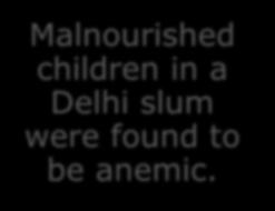 Malnourished children in a