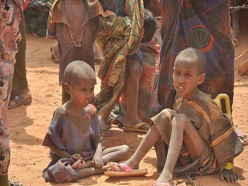 Malnutrition affects large numbers of children worldwide What symptoms