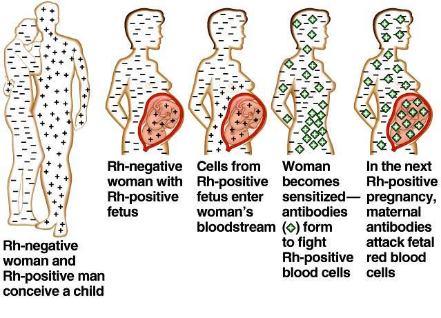 + baby or a Rh + transfusion) causes her body to synthesis Rh + antibodies The drug RhoGAM can prevent the Rh mother from