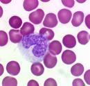 Neutrophils Neutrophils are the most numerous WBC 50-70% of WBC population Attracted to