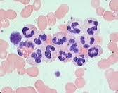 Lymphocytes Account for 25% or more of WBCs Only a small number is found in the blood Most