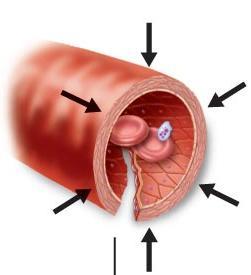 Vascular spasm Phase 2: Platelet plug formation Vasoconstriction of damaged vessel (significantly reduces blood