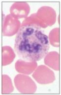 C) Leukocytes (white blood cells WBCs) Categories of Leukocytes: