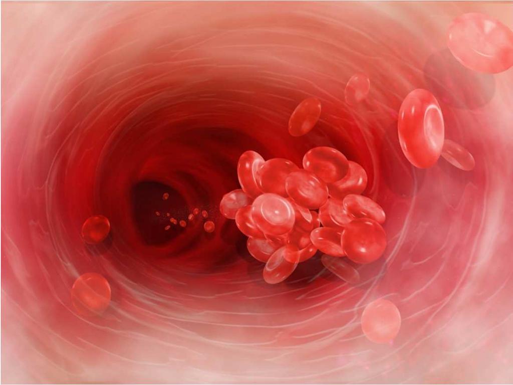 THROMBOSIS The formation of a blood clot in