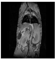 Pre-injection In vivo MR imaging of MaGICs 15