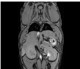 40 min GdDTPA MRI in C57BL6 mice at 7 T